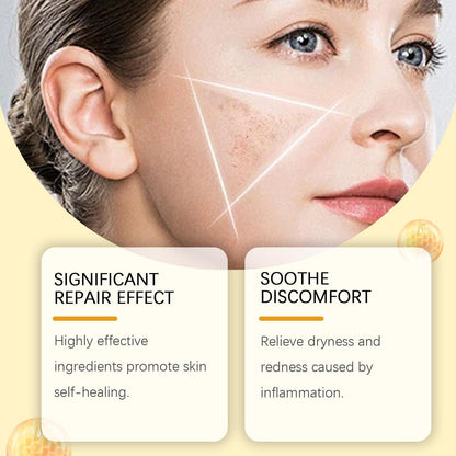 Houkeya Bee  Skin Care Cream Gentle Cleansing, Mole Removal, Moisturizing, Soothing Skin Care Cream