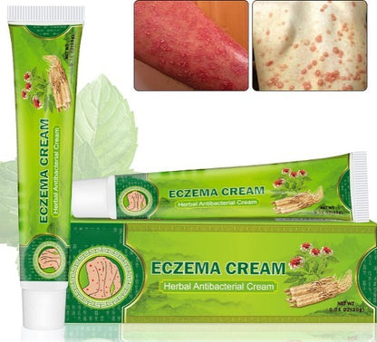 Sumifun - Eczema Skin Cream